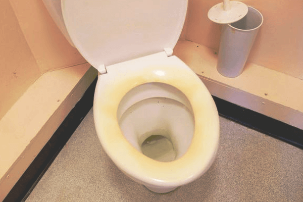What Causes Yellow Stains On Toilet Seat